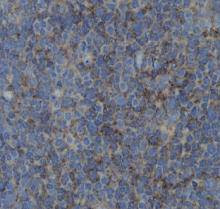 ZO1 Antibody in Immunohistochemistry (Paraffin) (IHC (P))