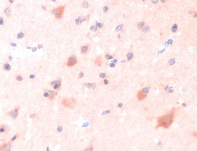 ERAB Antibody in Immunohistochemistry (IHC)