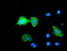 ERBB2 Antibody in Immunocytochemistry (ICC/IF)