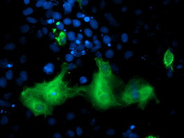 ERBB2 Antibody in Immunocytochemistry (ICC/IF)