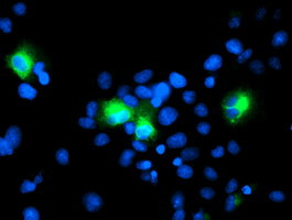 ERBB2 Antibody in Immunocytochemistry (ICC/IF)