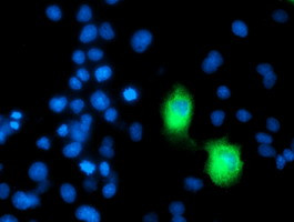 ERBB2 Antibody in Immunocytochemistry (ICC/IF)