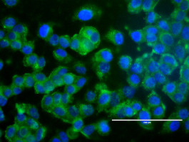 ERBB2 Antibody in Immunocytochemistry (ICC/IF)