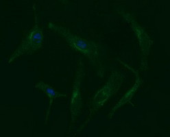 ERBB2 Antibody in Immunocytochemistry (ICC/IF)