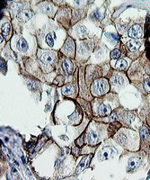 ERBB2 Antibody in Immunohistochemistry (Paraffin) (IHC (P))