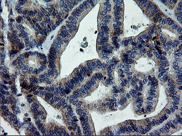 ERBB2 Antibody in Immunohistochemistry (Paraffin) (IHC (P))