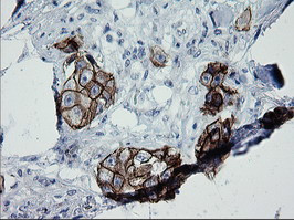 ERBB2 Antibody in Immunohistochemistry (Paraffin) (IHC (P))