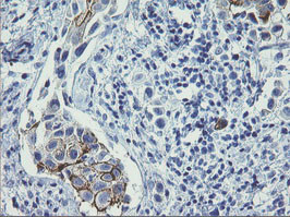 ERBB2 Antibody in Immunohistochemistry (Paraffin) (IHC (P))