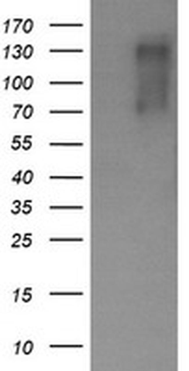 ERBB2 Antibody in Western Blot (WB)
