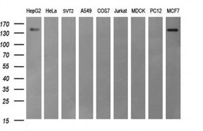 ERBB2 Antibody in Western Blot (WB)