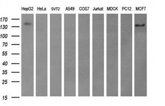ERBB2 Antibody in Western Blot (WB)