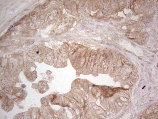 ERBB3 Antibody in Immunohistochemistry (Paraffin) (IHC (P))