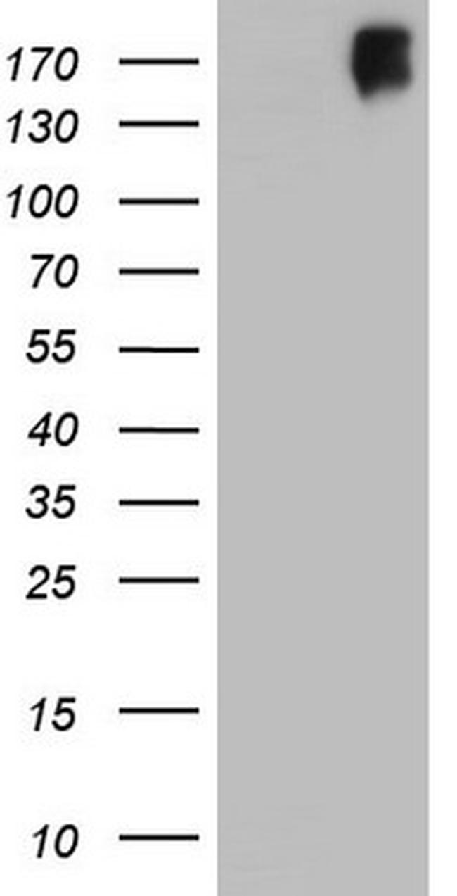 ERBB3 Antibody in Western Blot (WB)