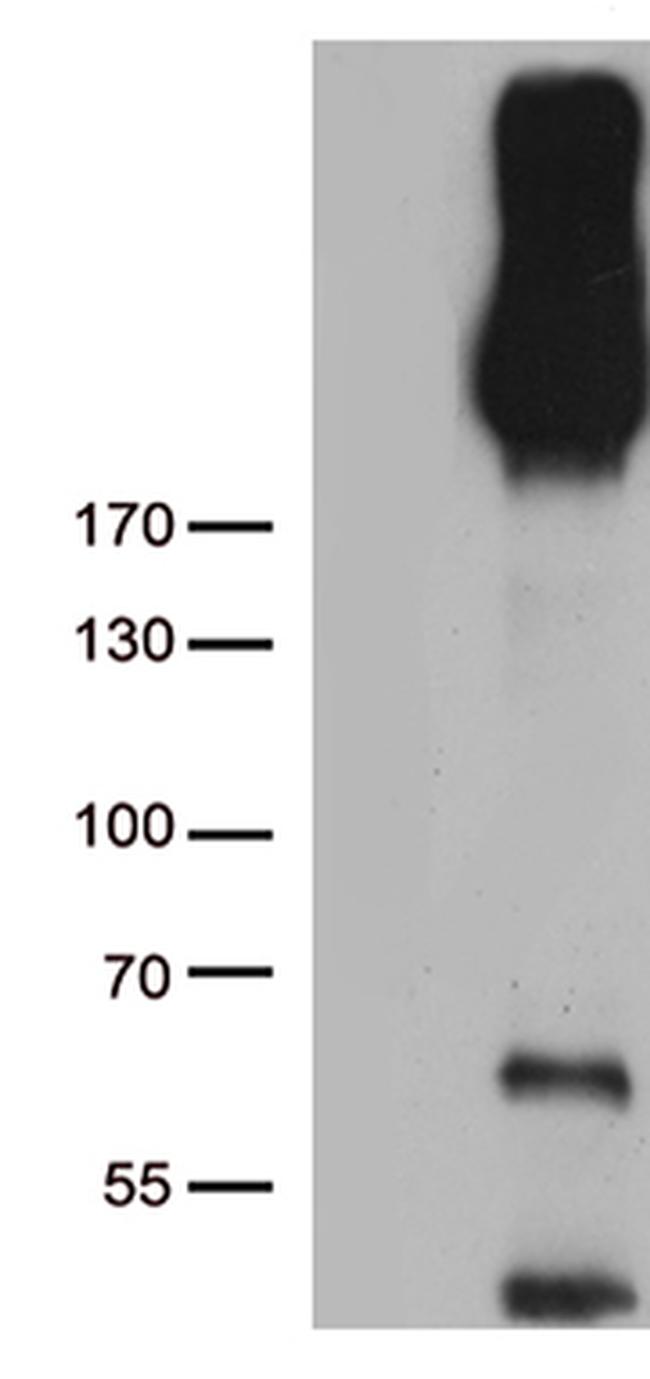 ERBB3 Antibody in Western Blot (WB)