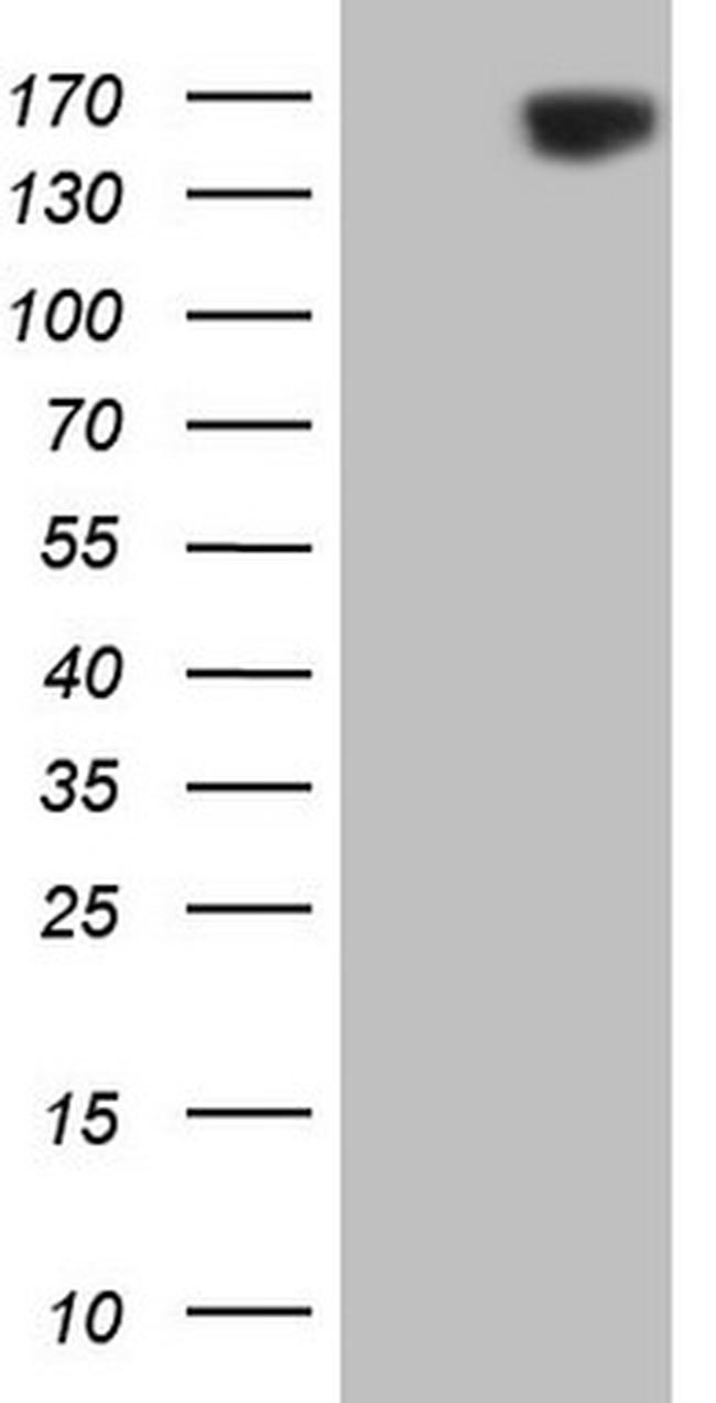 ERBB3 Antibody in Western Blot (WB)
