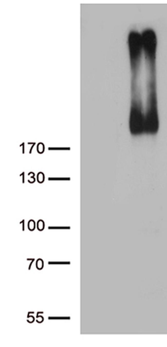 ERBB3 Antibody in Western Blot (WB)