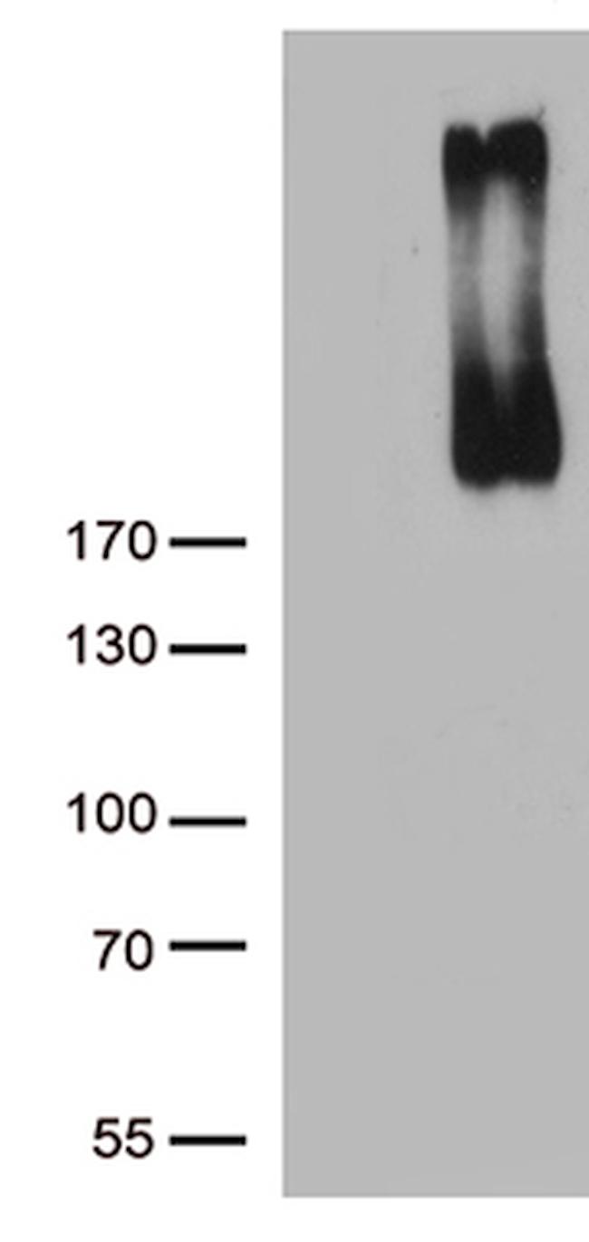 ERBB3 Antibody in Western Blot (WB)