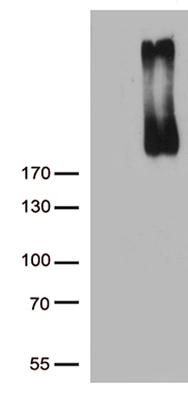 ERBB3 Antibody in Western Blot (WB)