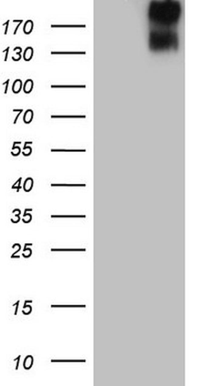 ERBB3 Antibody in Western Blot (WB)