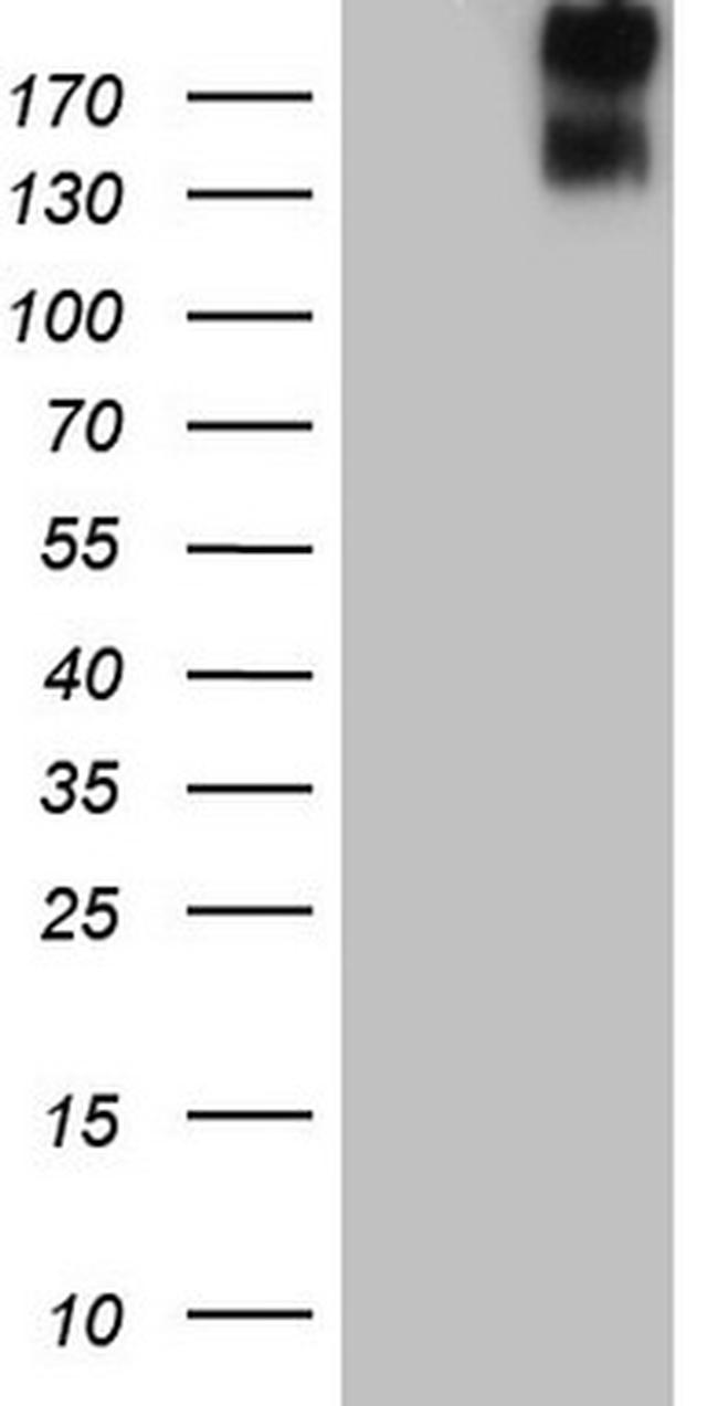 ERBB3 Antibody in Western Blot (WB)