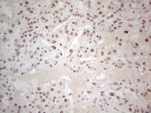 ERCC1 Antibody in Immunohistochemistry (Paraffin) (IHC (P))