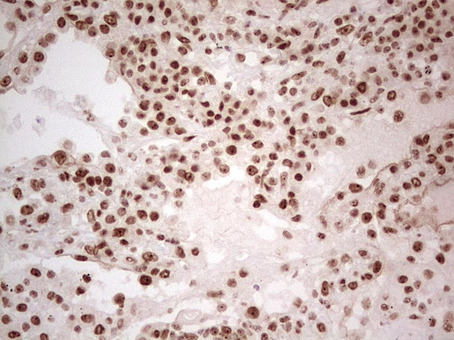 ERCC1 Antibody in Immunohistochemistry (Paraffin) (IHC (P))