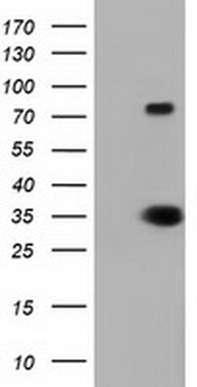 ERCC1 Antibody in Western Blot (WB)