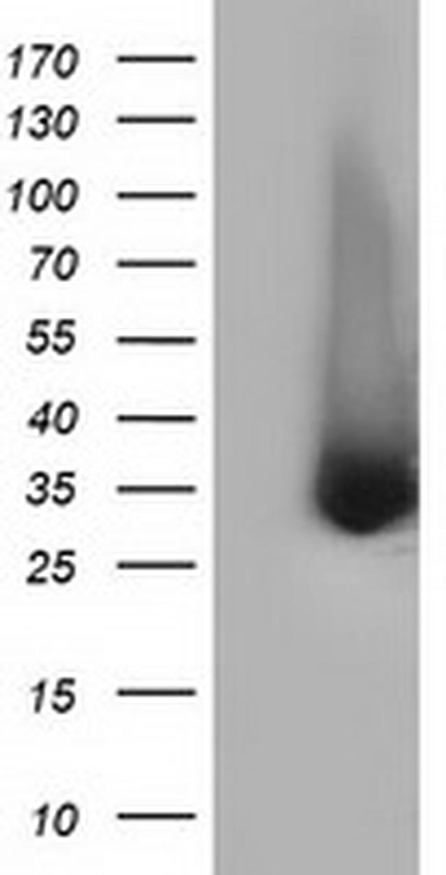 ERCC1 Antibody in Western Blot (WB)