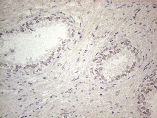 ERCC8 Antibody in Immunohistochemistry (Paraffin) (IHC (P))