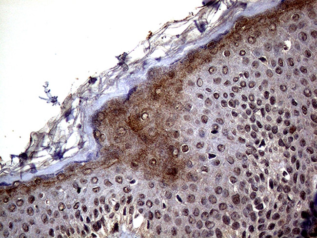 ERCC8 Antibody in Immunohistochemistry (Paraffin) (IHC (P))