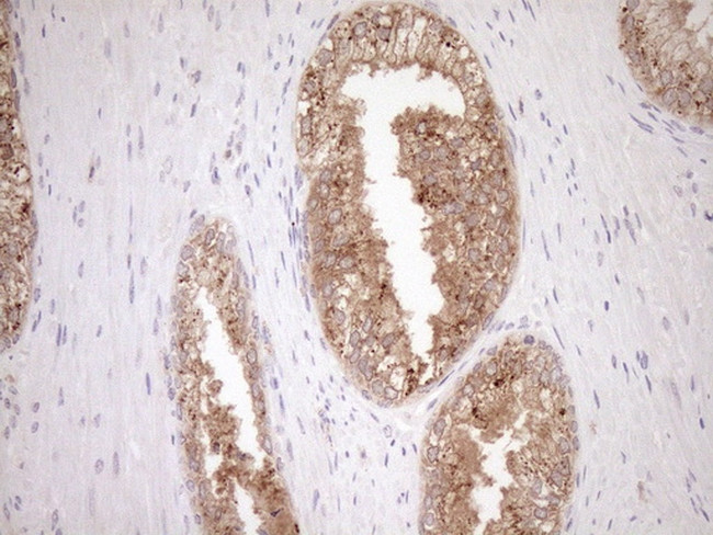 ERCC8 Antibody in Immunohistochemistry (Paraffin) (IHC (P))