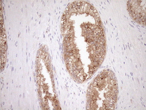 ERCC8 Antibody in Immunohistochemistry (Paraffin) (IHC (P))