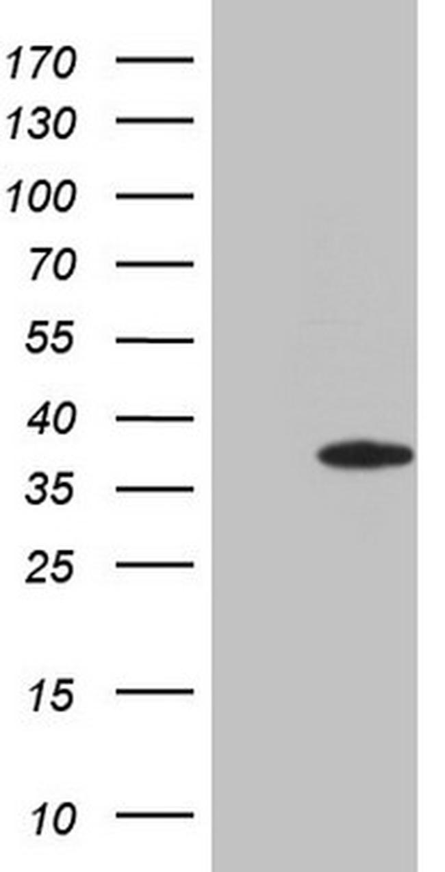 ERCC8 Antibody in Western Blot (WB)
