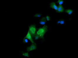 ERG Antibody in Immunocytochemistry (ICC/IF)
