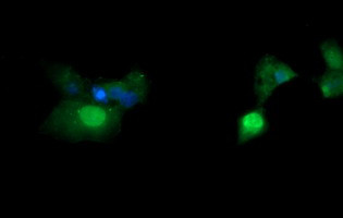 ERG Antibody in Immunocytochemistry (ICC/IF)