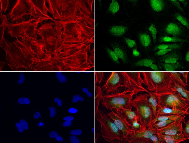 ERG Antibody in Immunocytochemistry (ICC/IF)