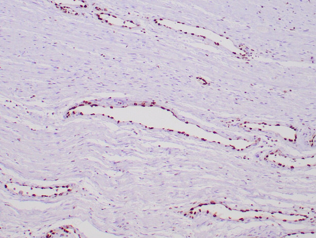ERG Antibody in Immunohistochemistry (Paraffin) (IHC (P))