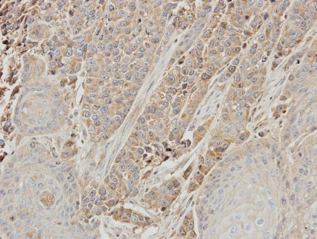 ERK1 Antibody in Immunohistochemistry (IHC)