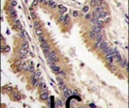 MAPK4 Antibody in Immunohistochemistry (IHC)