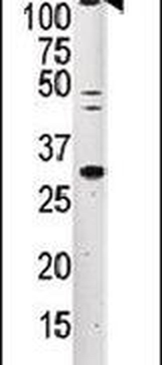 ERN2 Antibody in Western Blot (WB)