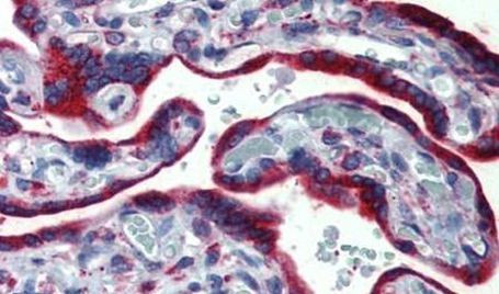 ERP44 Antibody in Immunohistochemistry (Paraffin) (IHC (P))