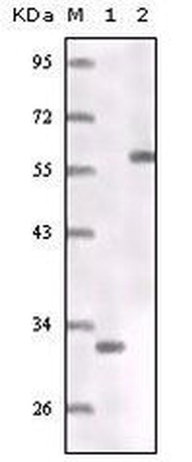 Estrogen Receptor alpha Antibody in Western Blot (WB)