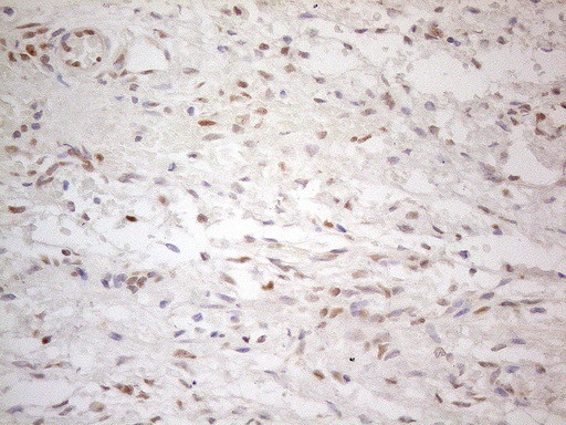 ESR1 Antibody in Immunohistochemistry (Paraffin) (IHC (P))