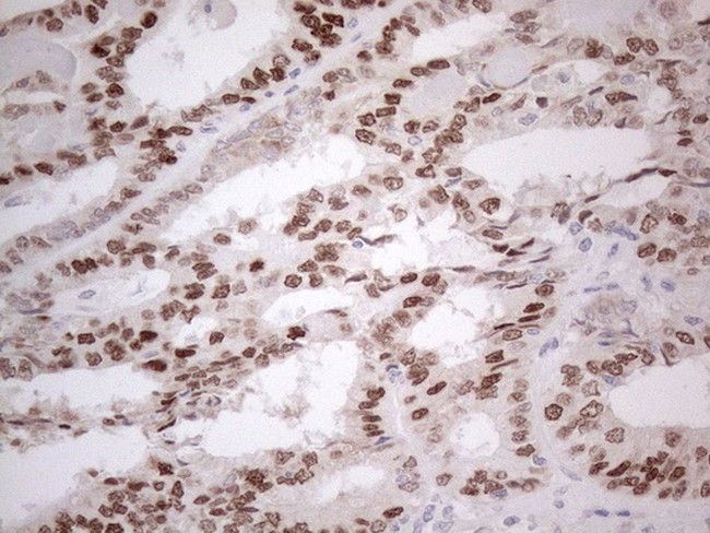 ESR1 Antibody in Immunohistochemistry (Paraffin) (IHC (P))