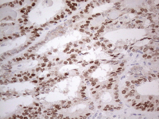 ESR1 Antibody in Immunohistochemistry (Paraffin) (IHC (P))