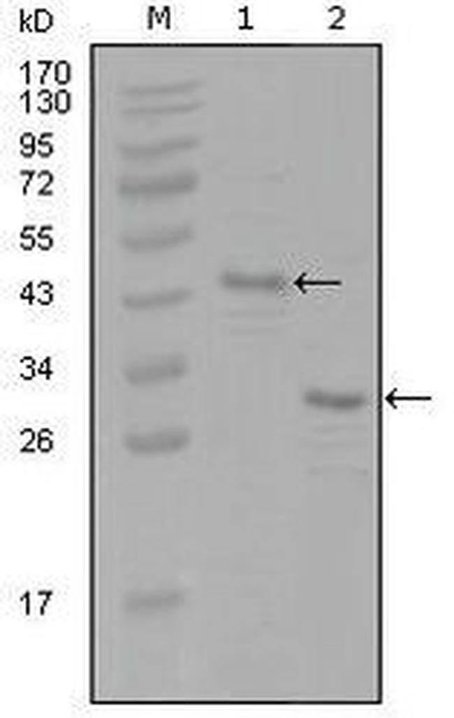 Estrogen Receptor alpha Antibody in Western Blot (WB)