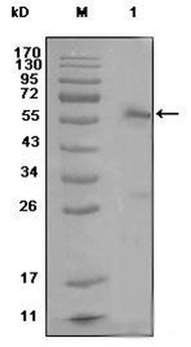 Estrogen Receptor alpha Antibody in Western Blot (WB)