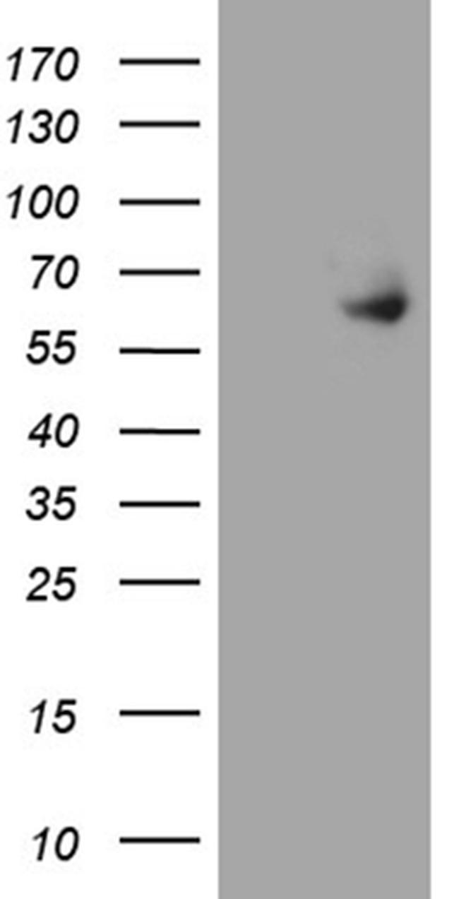 ESR2 Antibody in Western Blot (WB)