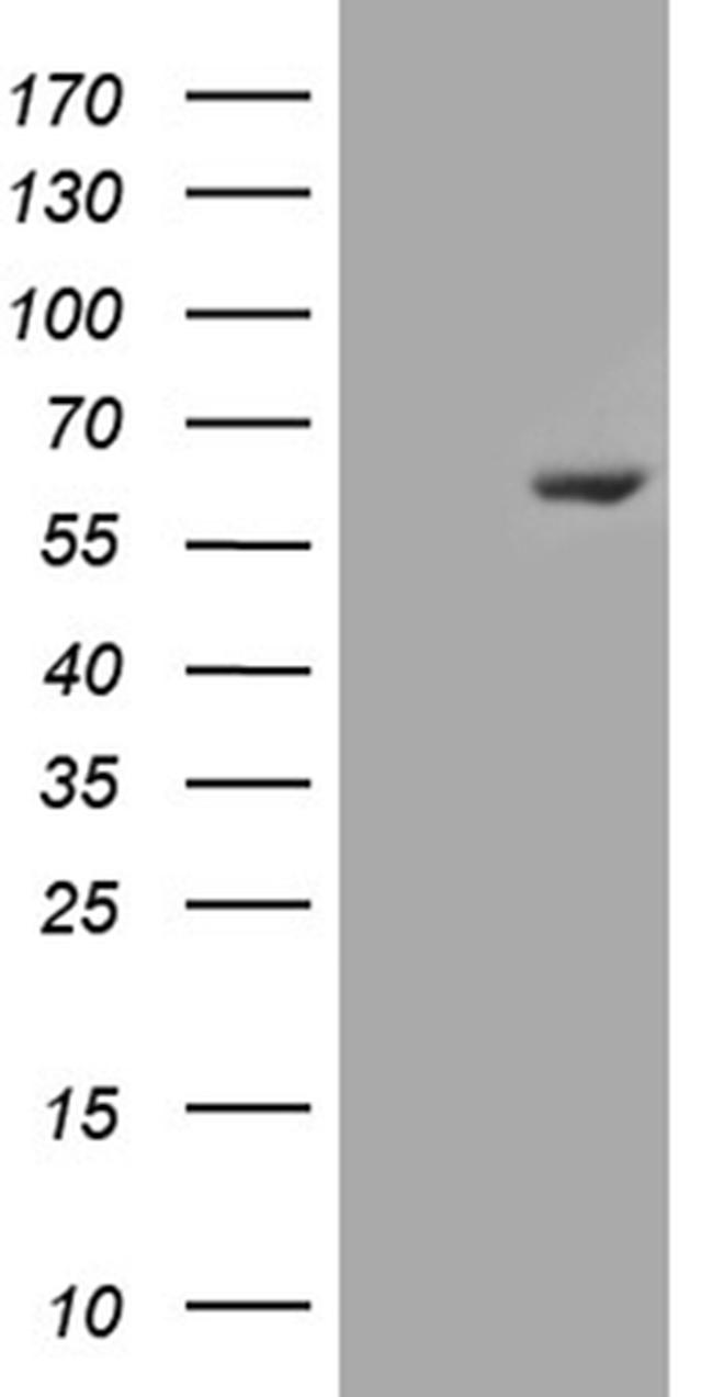 ESR2 Antibody in Western Blot (WB)