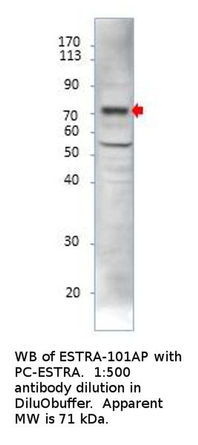 Estrogen Receptor alpha Antibody in Western Blot (WB)